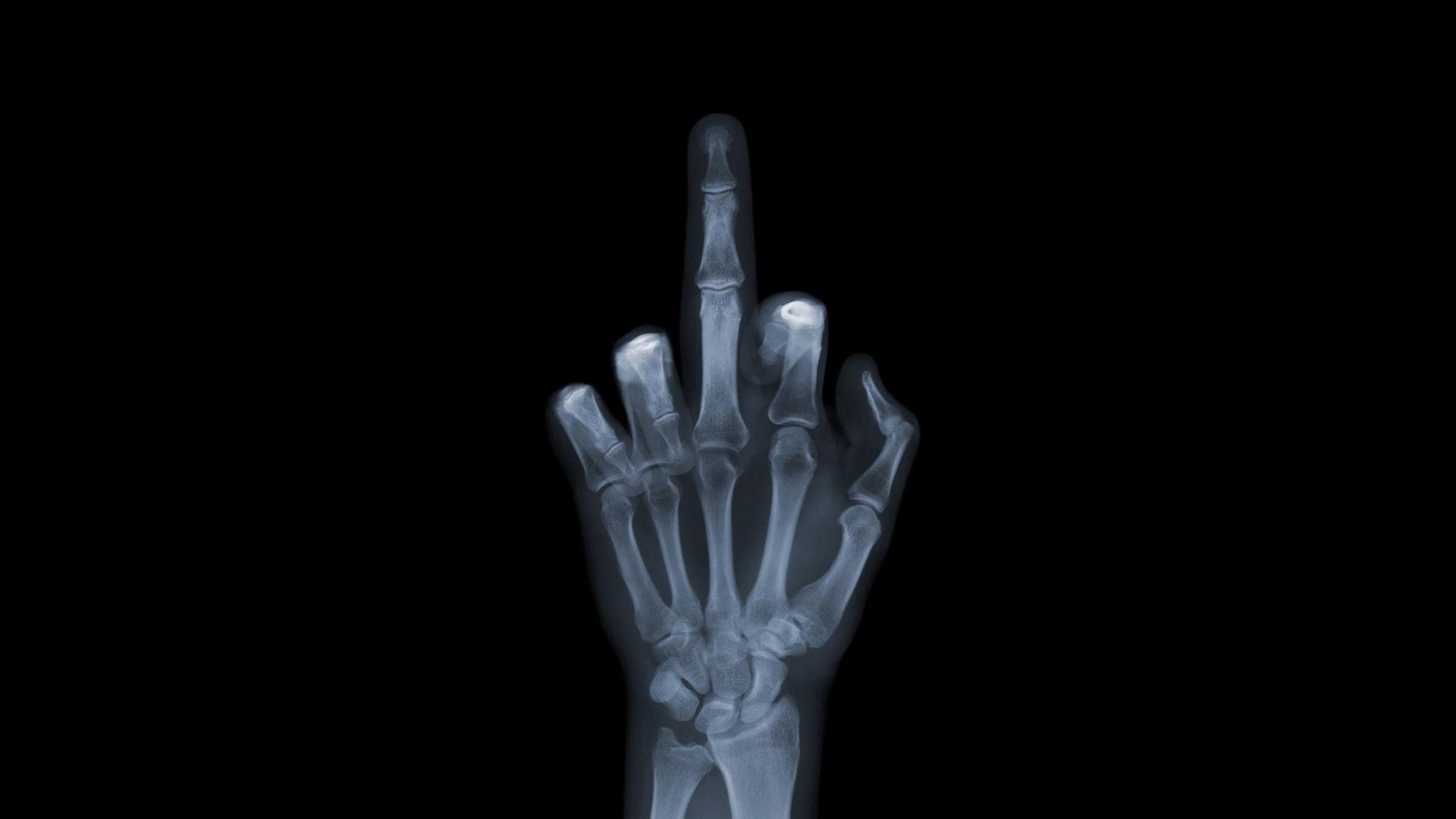 Radiografia, Dito medio, Mano, Sfondo nero, Full HD, wallpaper desktop