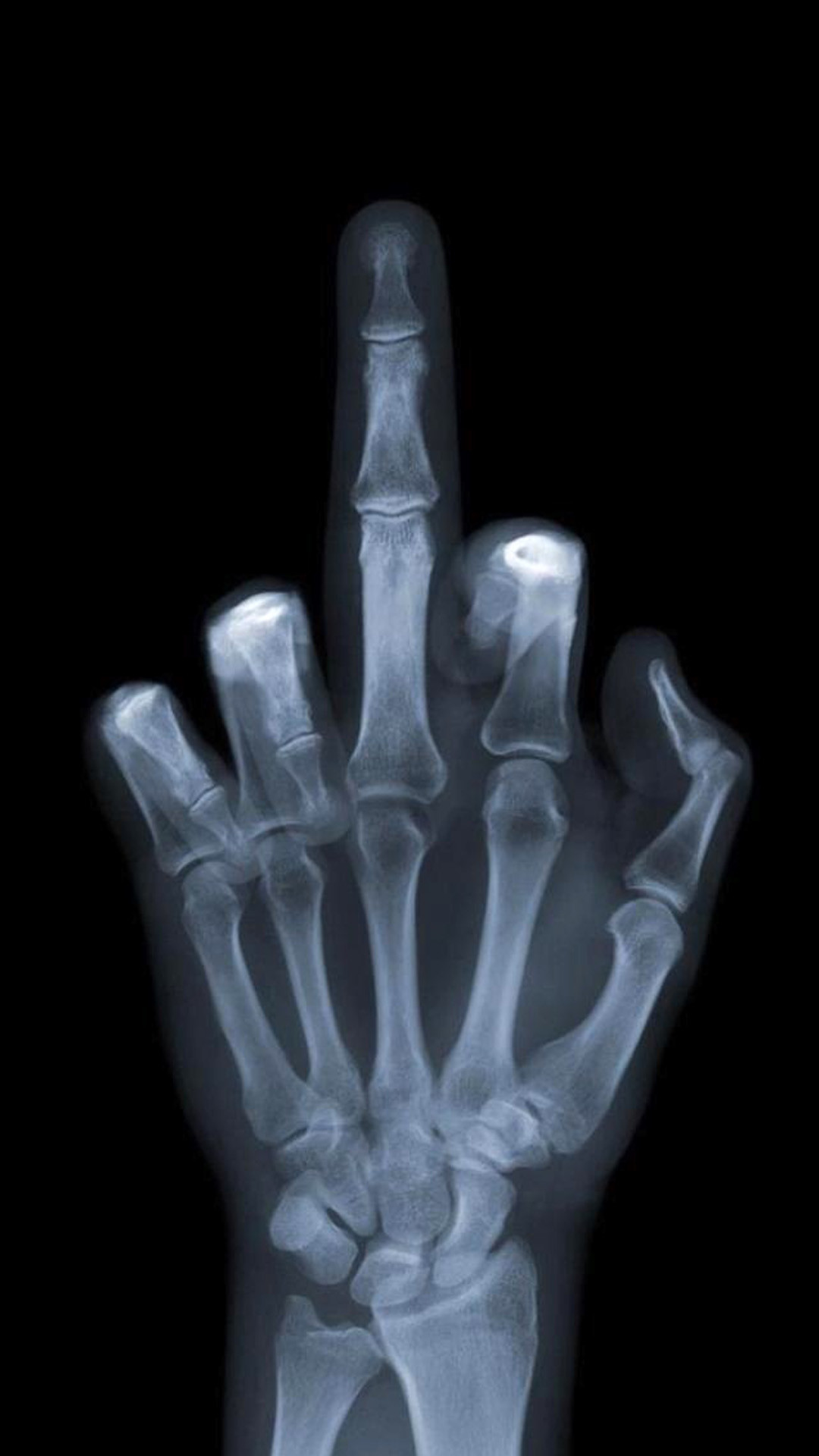 Radiografia, Dito medio, Mano, Sfondo nero, Full HD, schermata di blocco iPhone 6S